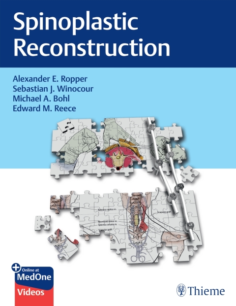 Cover image for book Spinoplastic Reconstruction