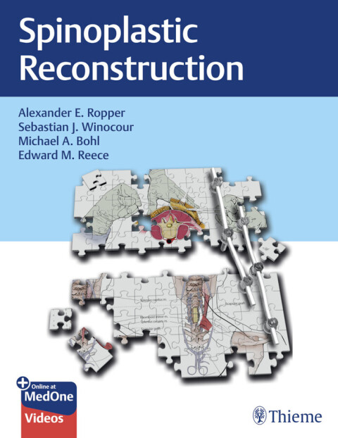 Cover image for book Spinoplastic Reconstruction