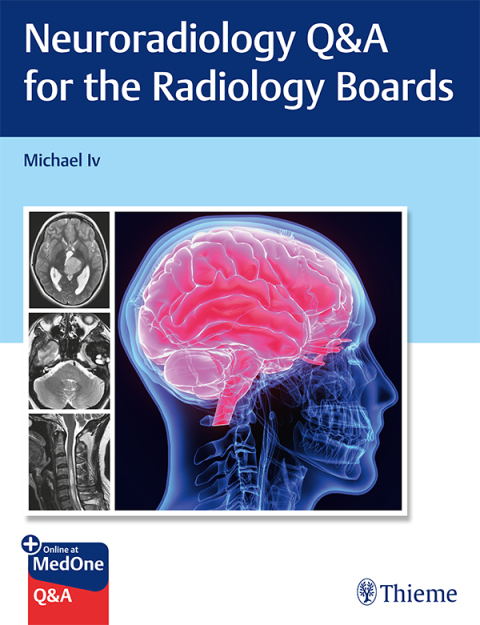 Cover image for book Neuroradiology Q&A for the Radiology Boards