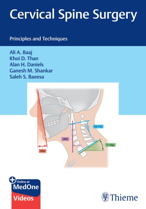 Cover image for book Cervical Spine Surgery
