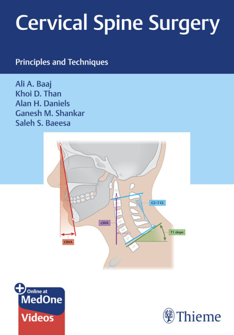 Cover image for book Cervical Spine Surgery