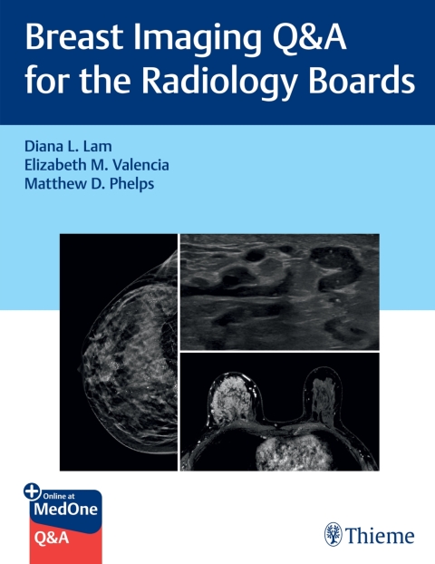 Cover image for book Breast Imaging Q&A for the Radiology Boards