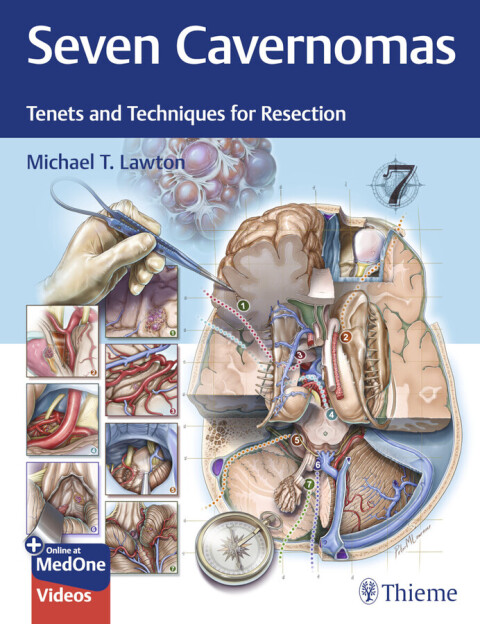 Cover image for book Seven Cavernomas
