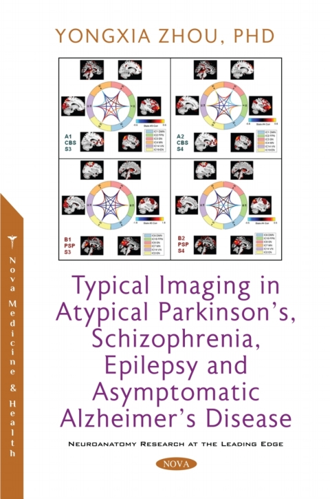 Cover image for book Typical Imaging in Atypical Parkinson's, Schizophrenia, Epilepsy and Asymptomatic Alzheimer's Disease