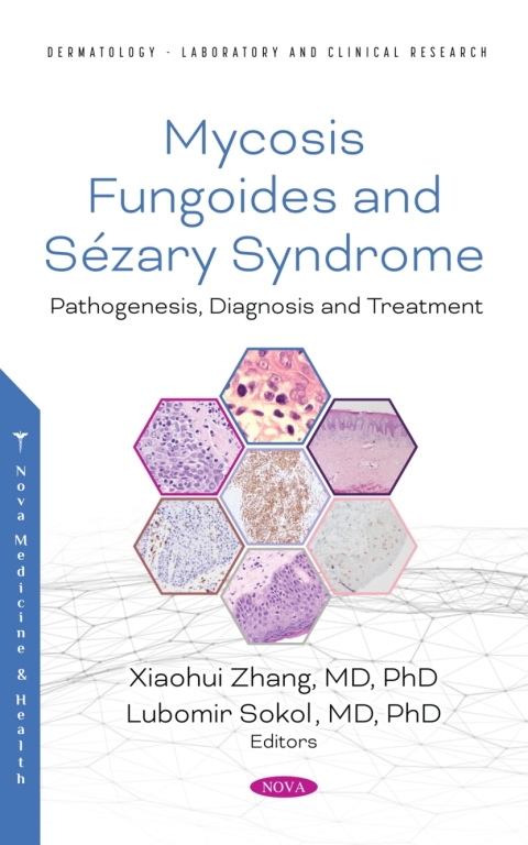 Cover image for book Mycosis Fungoides: Causes, Diagnosis and Treatment