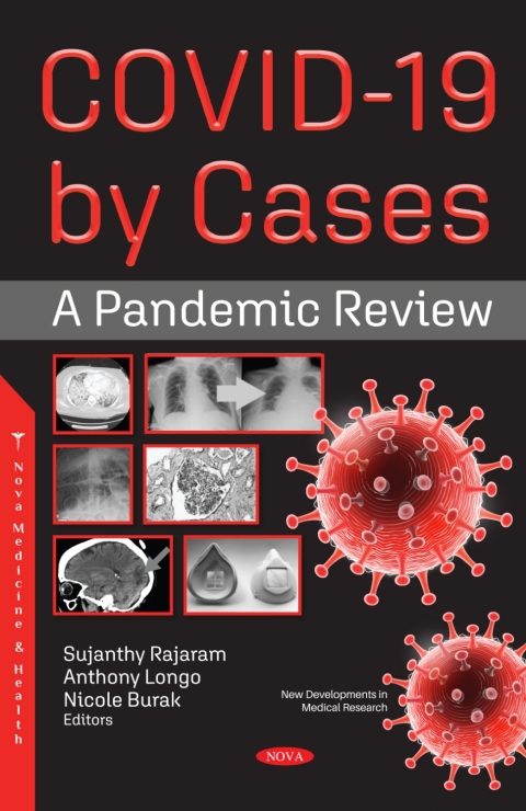 Cover image for book COVID-19 by Cases: A Pandemic Review