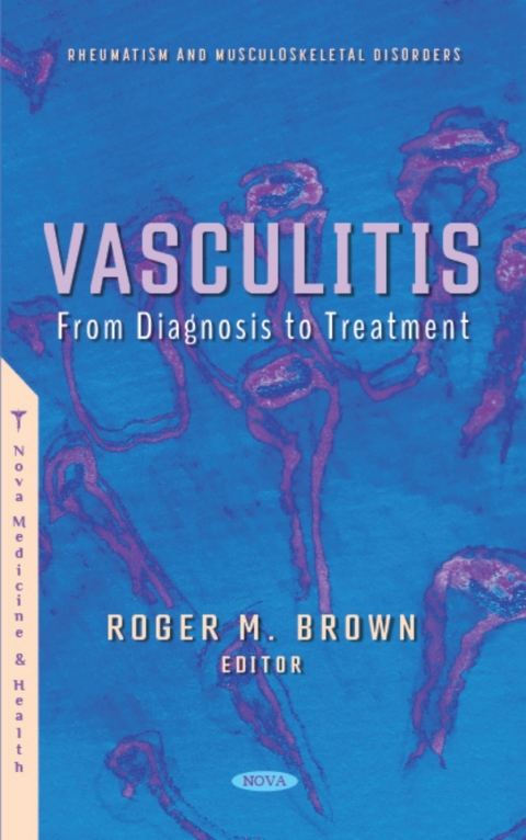 Cover image for book Vasculitis: From Diagnosis to Treatment