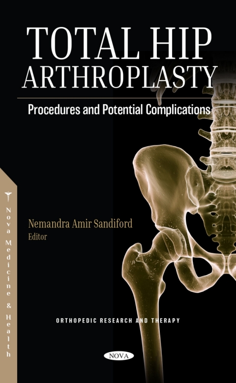 Cover image for book Total Hip Arthroplasty: Procedures and Potential Complications