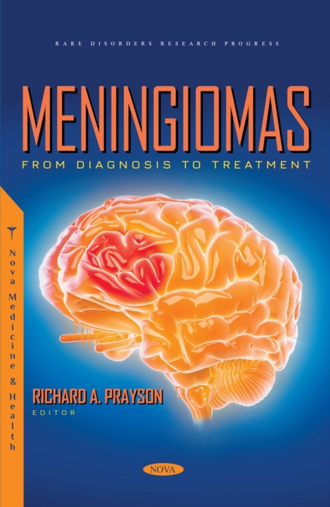 Cover image for book Meningiomas: From Diagnosis to Treatment