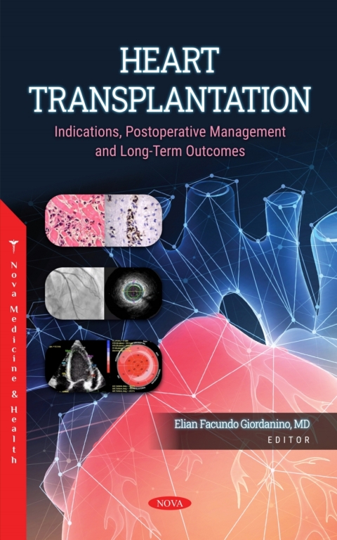 Cover image for book Heart Transplantation: Indications, Postoperative Management and Long-Term Outcomes