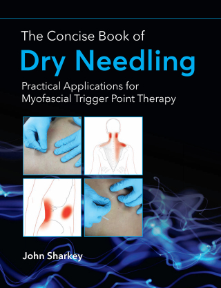 The Concise Book of Dry Needling