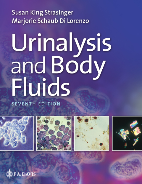 Cover image for book Urinalysis and Body Fluids