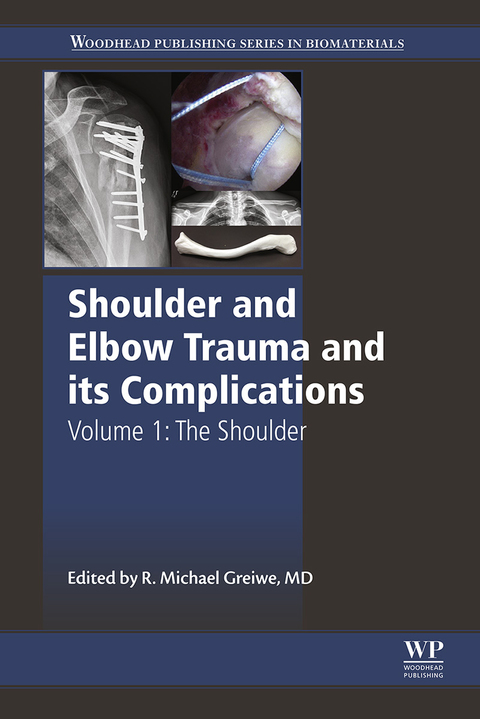 Cover image for book Shoulder and Elbow Trauma and its Complications