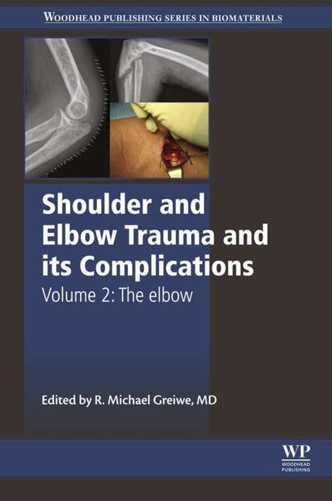 Cover image for book Shoulder and Elbow Trauma and its Complications: The Elbow