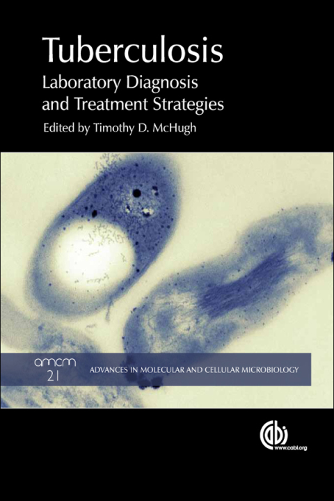 Cover image for book Tuberculosis