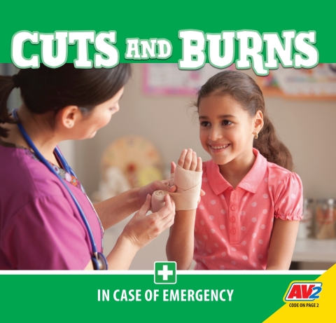 Cover image for book Cuts and Burns