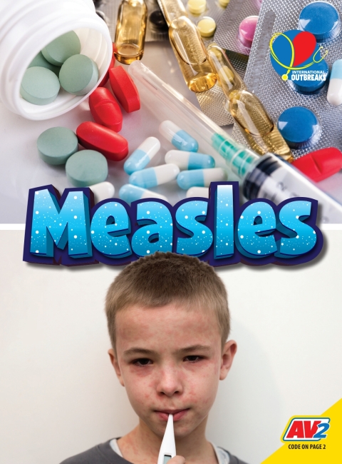 Cover image for book Measles