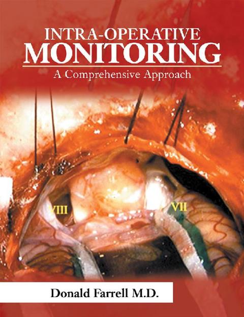 Cover image for book Intra-Operative Monitoring