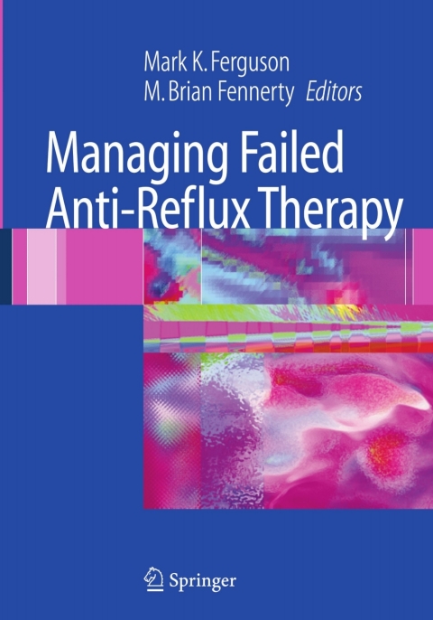 Cover image for book Managing Failed Anti-Reflux Therapy