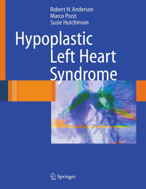 Hypoplastic Left Heart Syndrome 