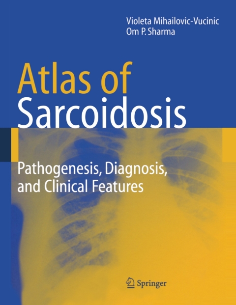 Cover image for book Atlas of Sarcoidosis