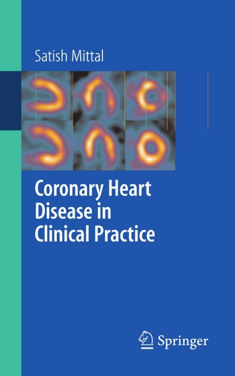 Cover image for book Coronary Heart Disease in Clinical Practice