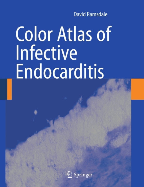 Cover image for book Color Atlas of Infective Endocarditis