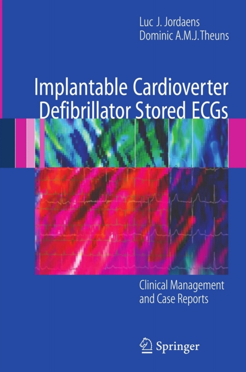 Cover image for book Implantable Cardioverter Defibrillator Stored ECGs