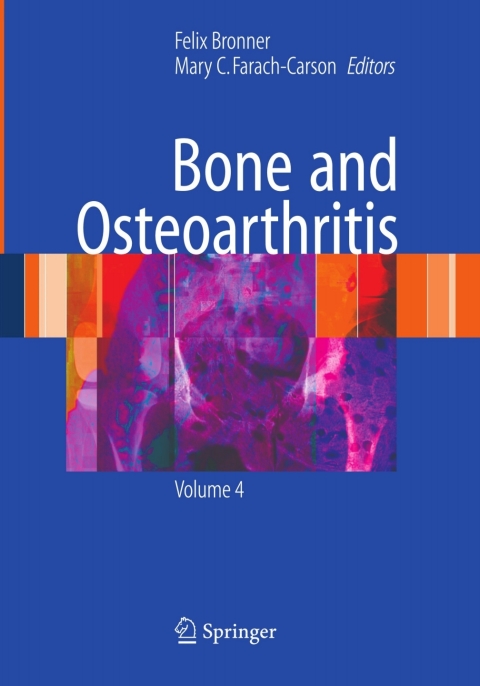 Cover image for book Bone and Osteoarthritis