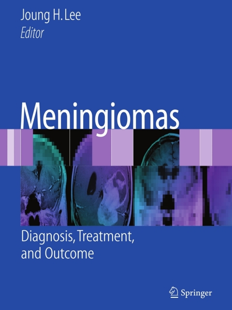Cover image for book Meningiomas
