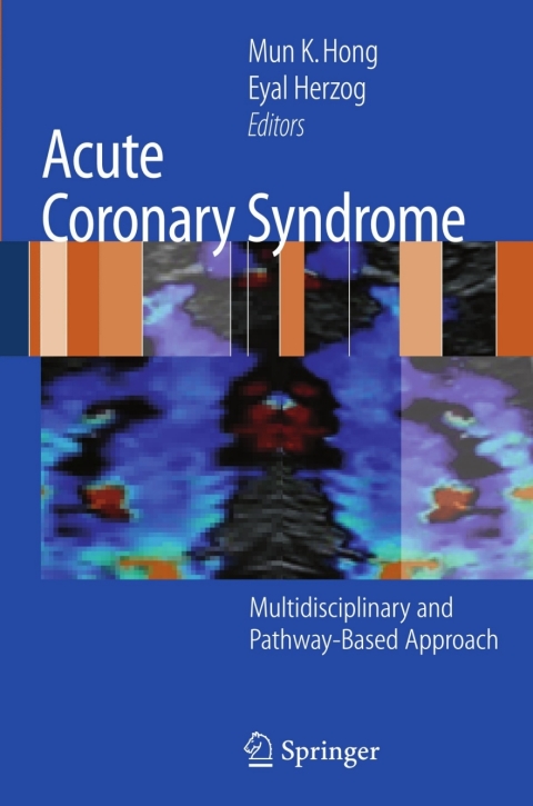 Cover image for book Acute Coronary Syndrome