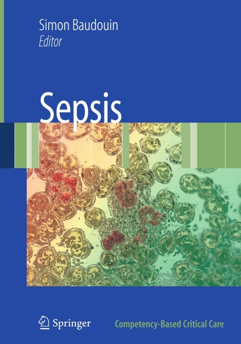 Cover image for book Sepsis