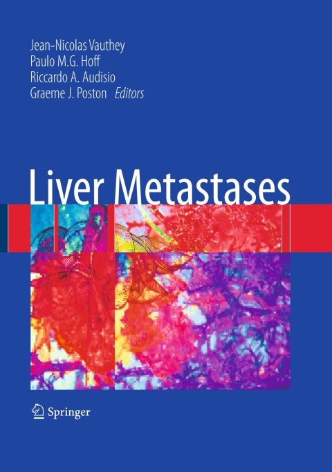 Cover image for book Liver Metastases
