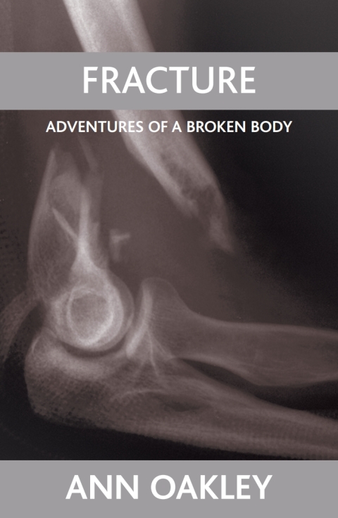 Cover image for book Fracture