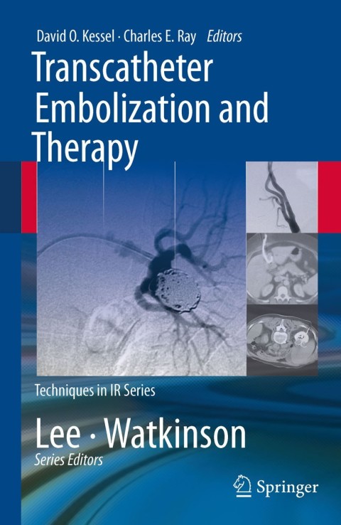 Cover image for book Transcatheter Embolization and Therapy