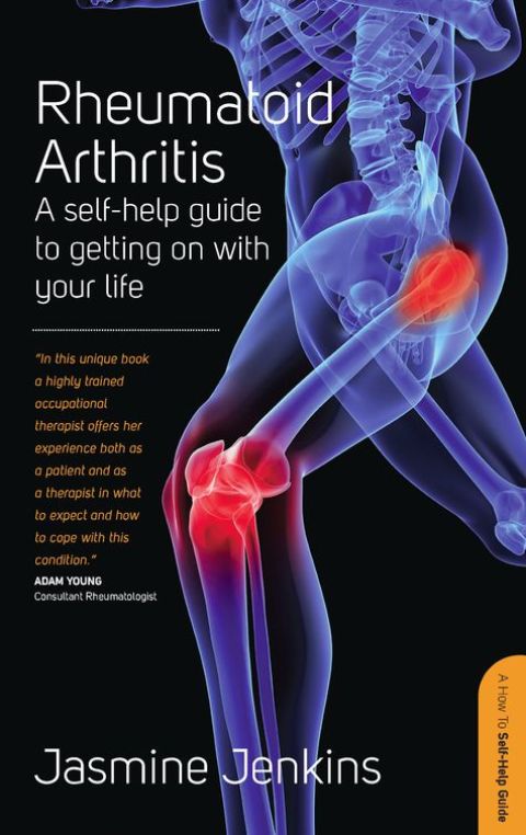 Cover image for book Rheumatoid Arthritis
