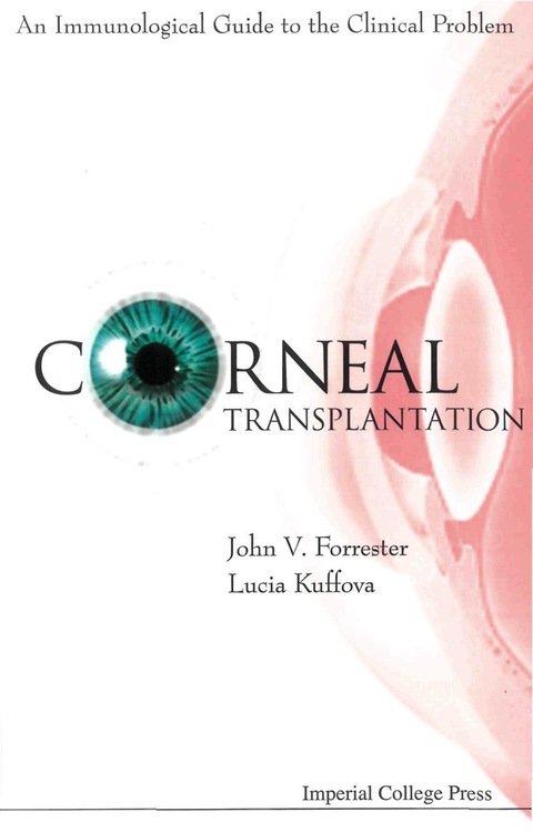 Cover image for book Corneal Transplantation