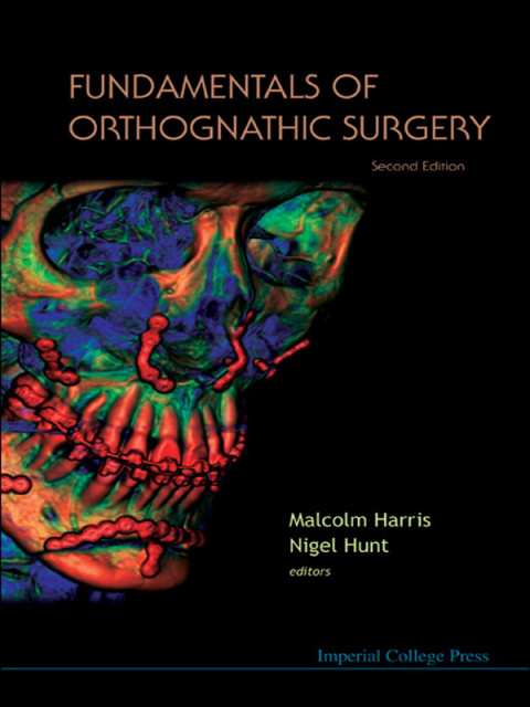 Cover image for book Fundamentals of Orthognathic Surgery