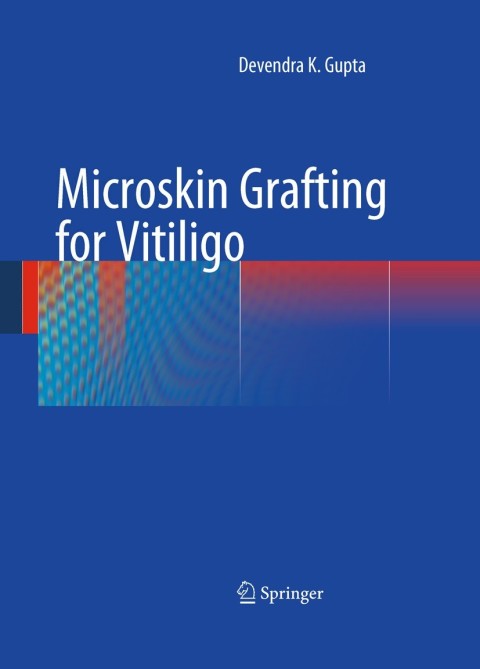 Cover image for book Microskin Grafting for Vitiligo