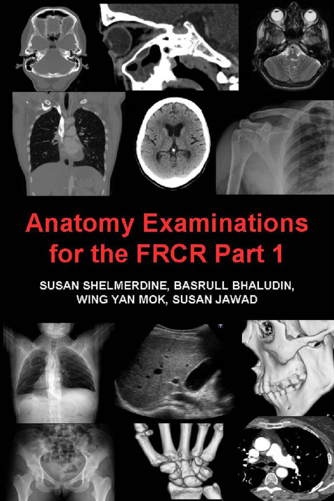 Cover image for book Anatomy Examinations for the FRCR Part 1