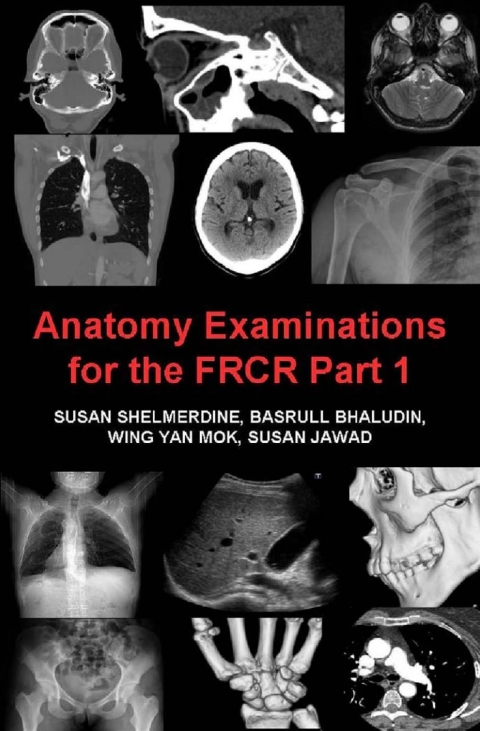 Cover image for book Anatomy Examinations for the FRCR Part 1