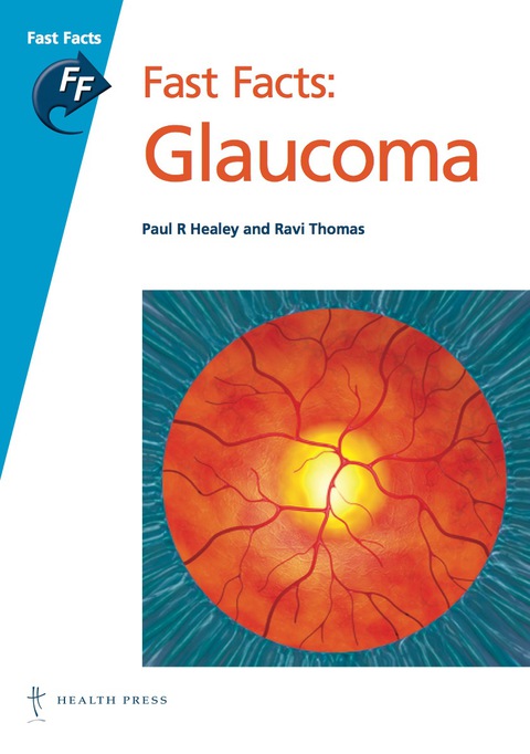 Cover image for book Fast Facts: Glaucoma