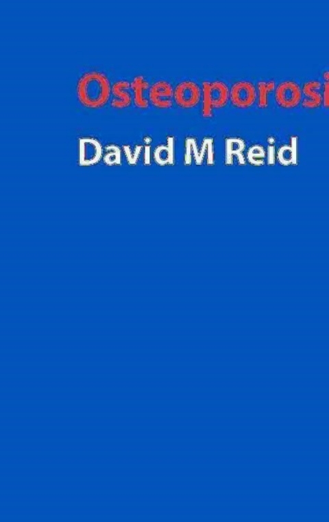 Cover image for book Handbook of Osteoporosis