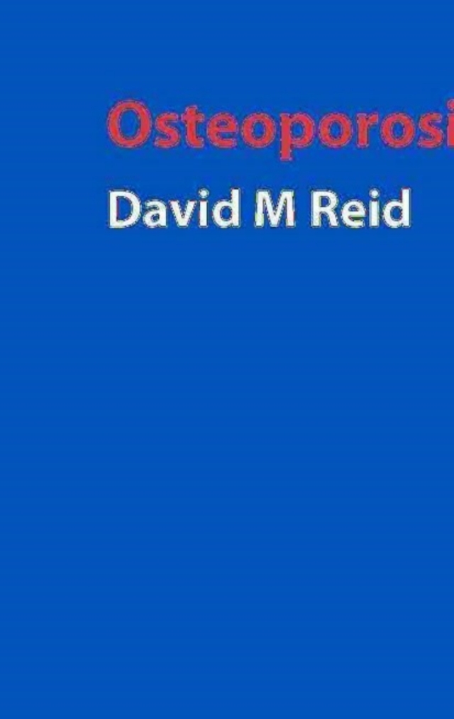 Handbook of Osteoporosis