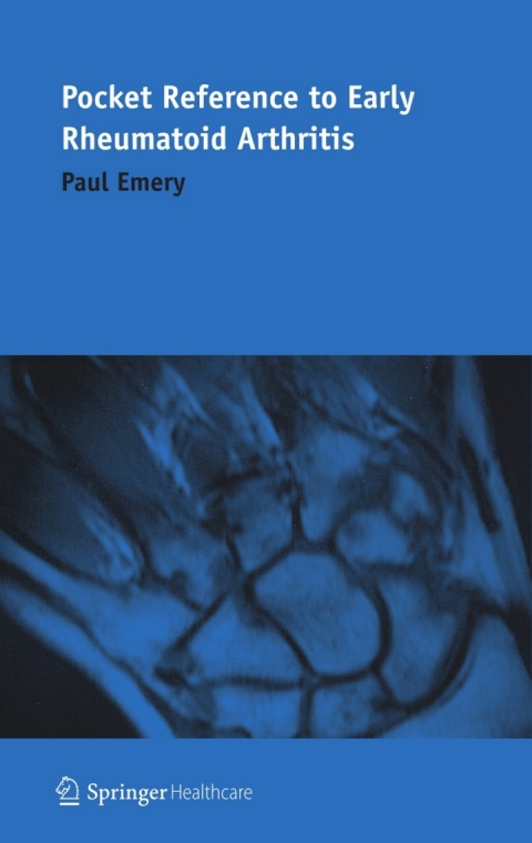 Cover image for book Pocket Reference to Early Rheumatoid Arthritis