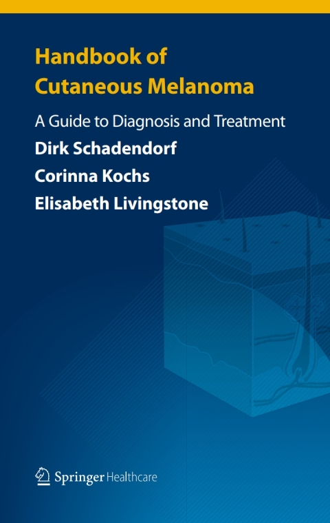 Handbook of Cutaneous Melanoma 
