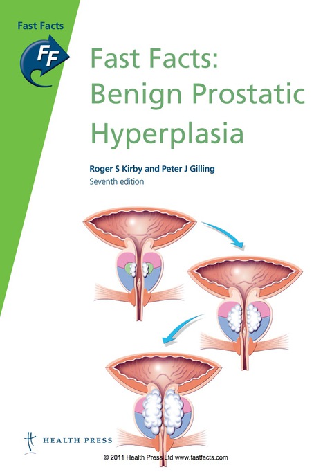 Fast Facts: Benign Prostatic Hyperplasia 