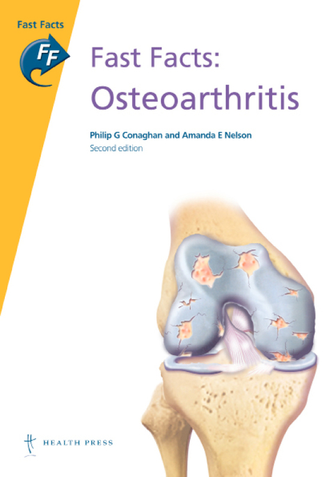 Fast Facts: Osteoarthritis 