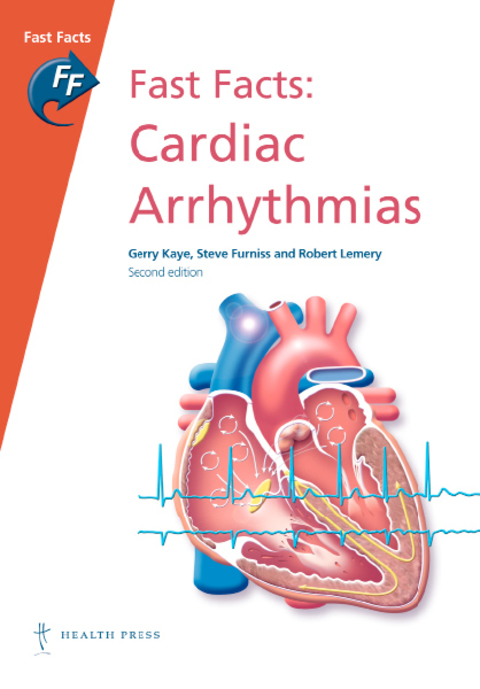 Fast Facts: Cardiac Arrhythmias 