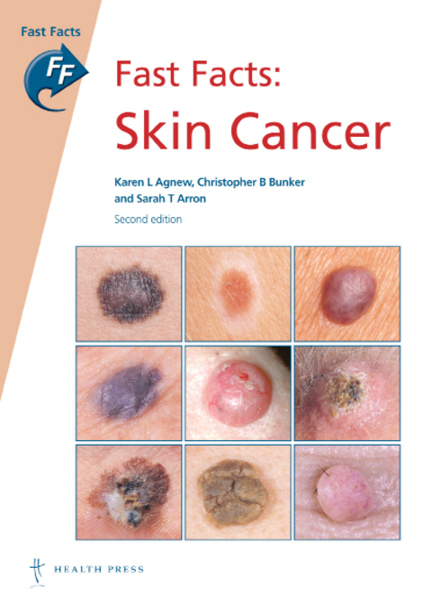 Cover image for book Fast Facts: Skin Cancer